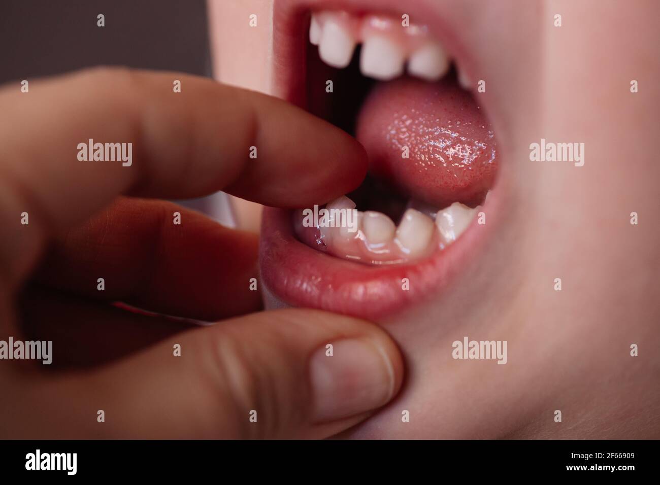 Permanent teeth hires stock photography and images Alamy