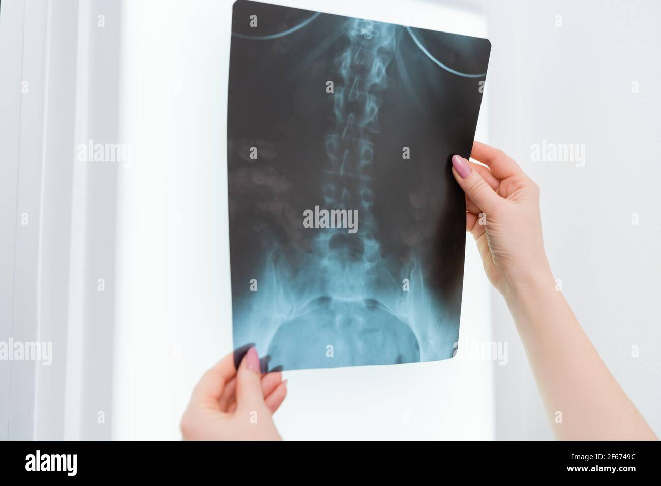Radiology Center High Resolution Stock Photography And Images Alamy