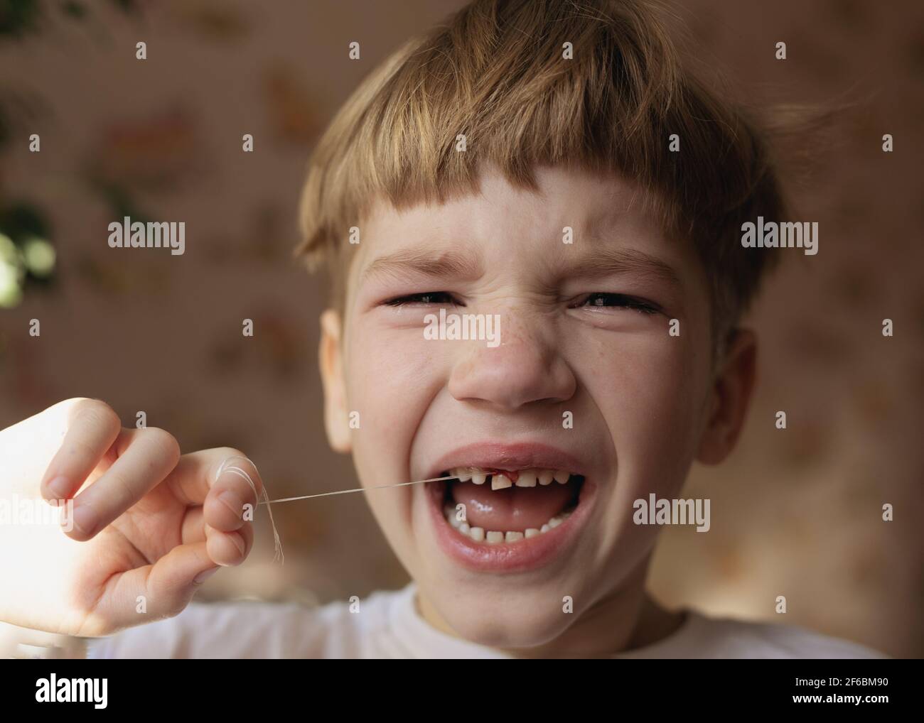 kid screams in fear and pain, crying boy tries to pull out his baby tooth with thread Stock