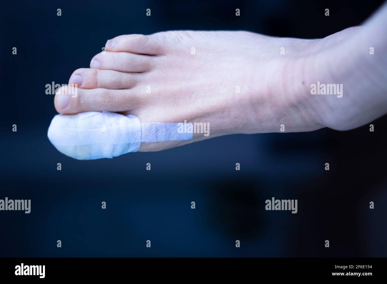 Foot big toe bandage injured feet in medical clinic hospital center