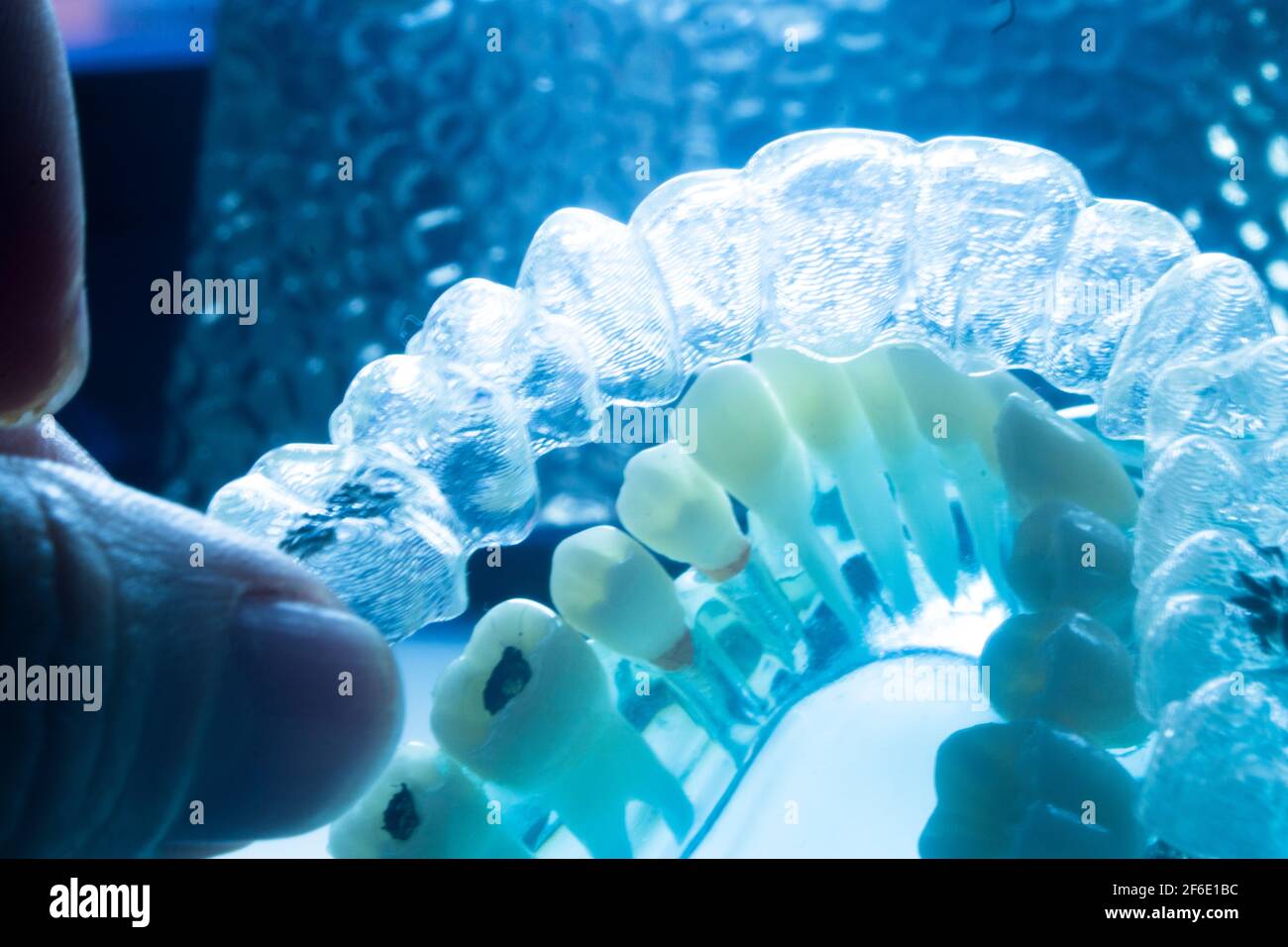 Modern invisible brackets aligner straighterners used to correct