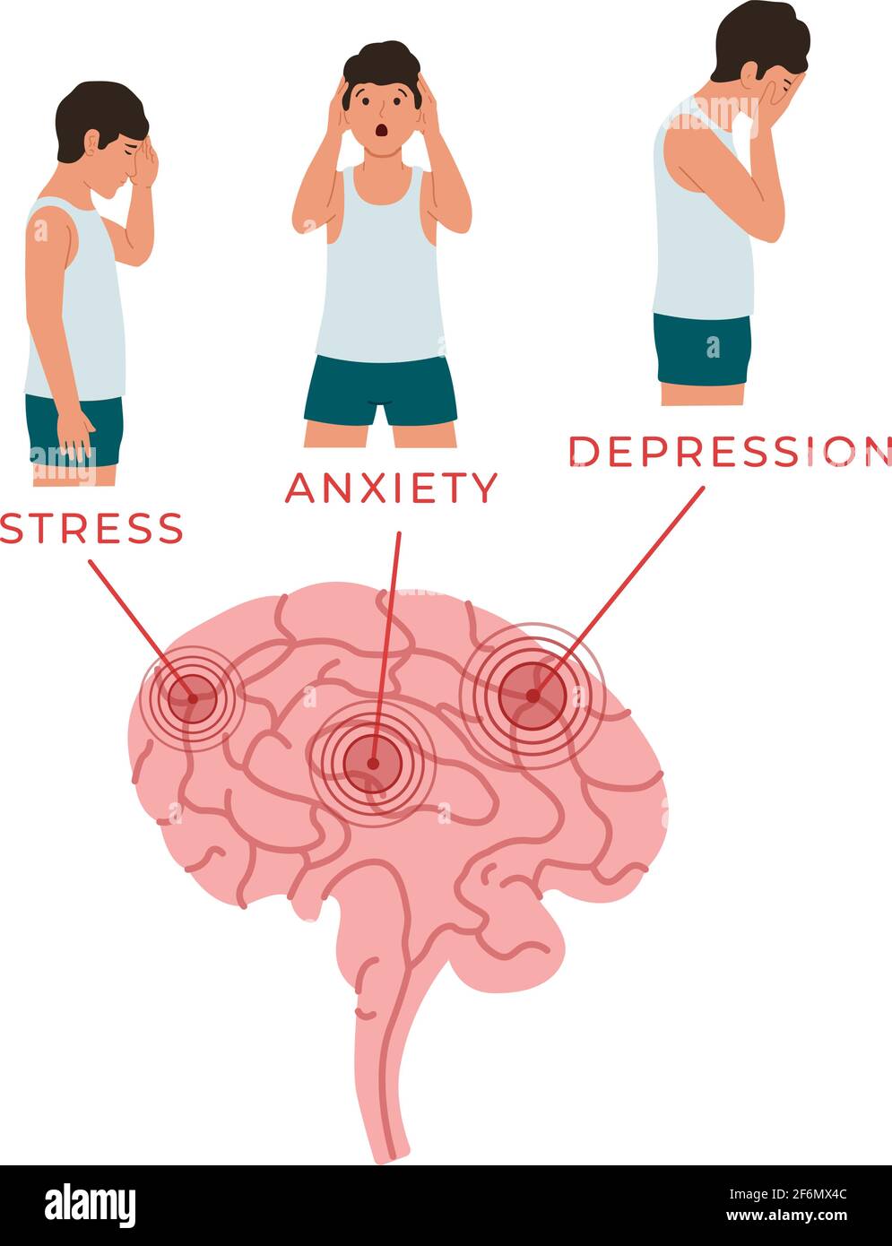 Vector Illustration Of The Brain And People Who Experience Stress