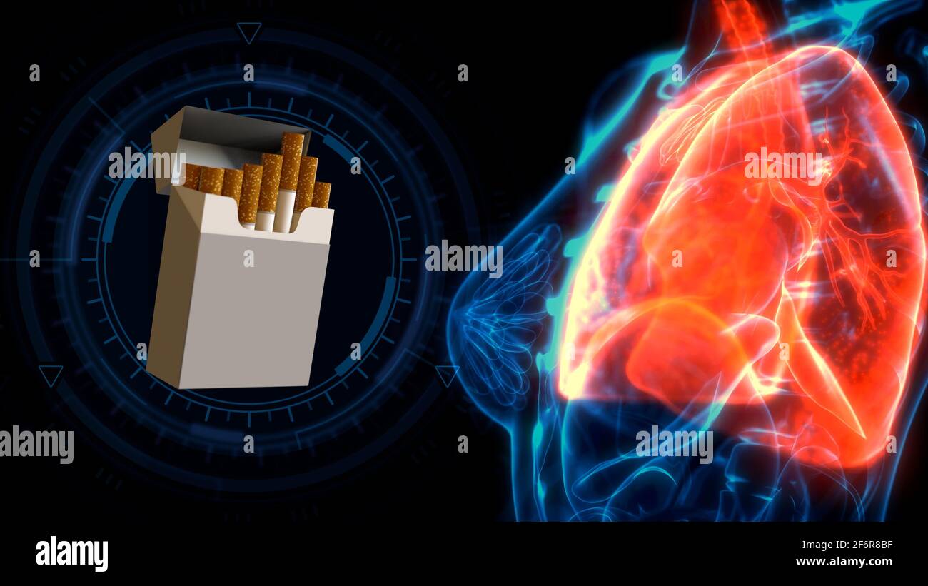 cg healthcare 3d illustration, human lungs pain by cigarettes Stock ...