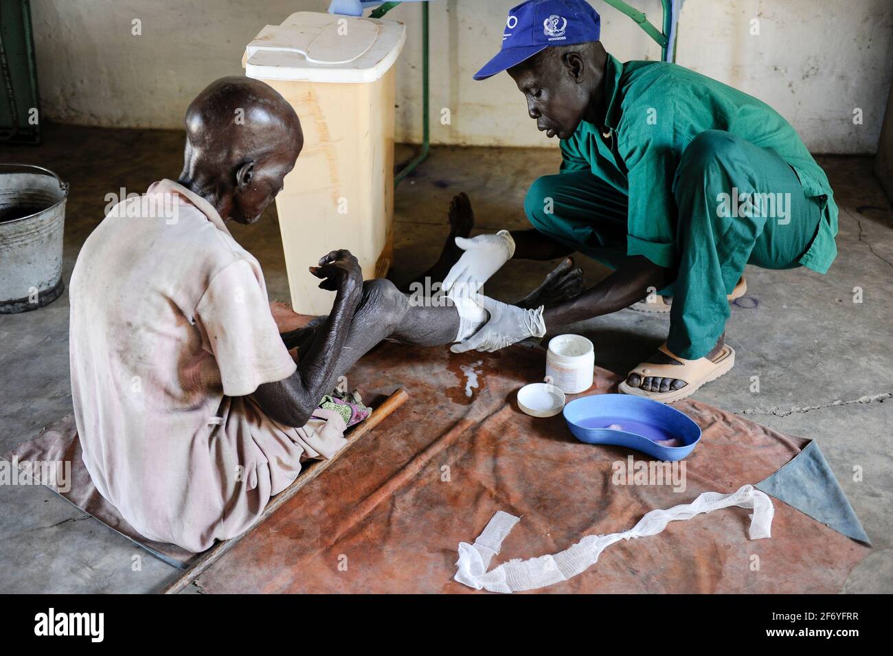 SOUTH-SUDAN, Cuibet , rural health station in Agangrial, patient with leg wound / SUED-SUDAN, laendliche Gesundheitsstation Agangrial in Cuibet County Stock Photo