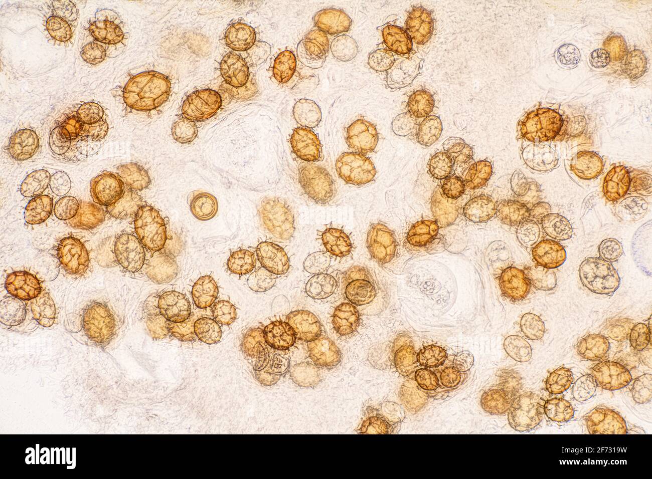 Mushroom spores microscope hi-res stock photography and images - Alamy