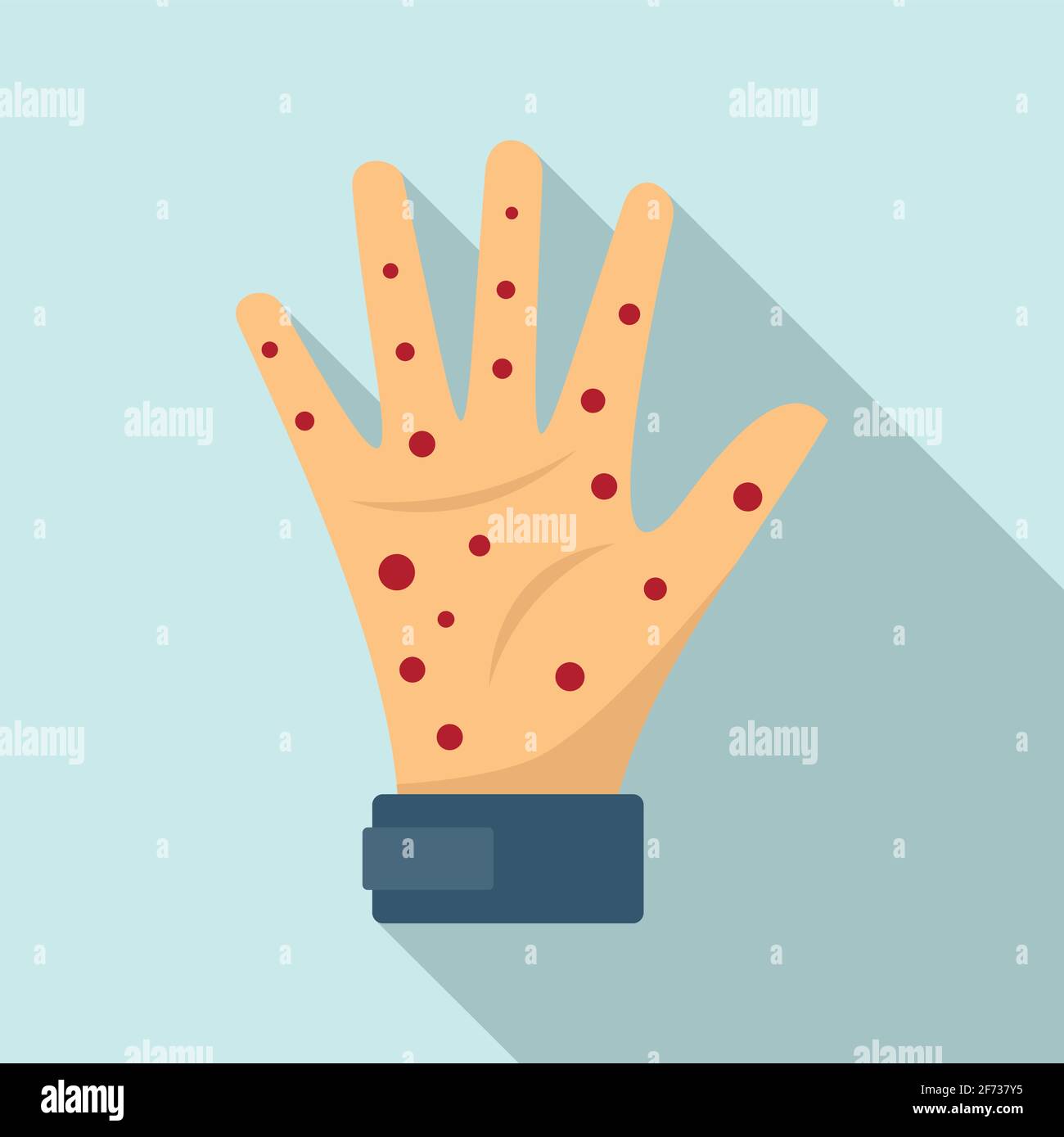 Hand measles icon, flat style Stock Vector