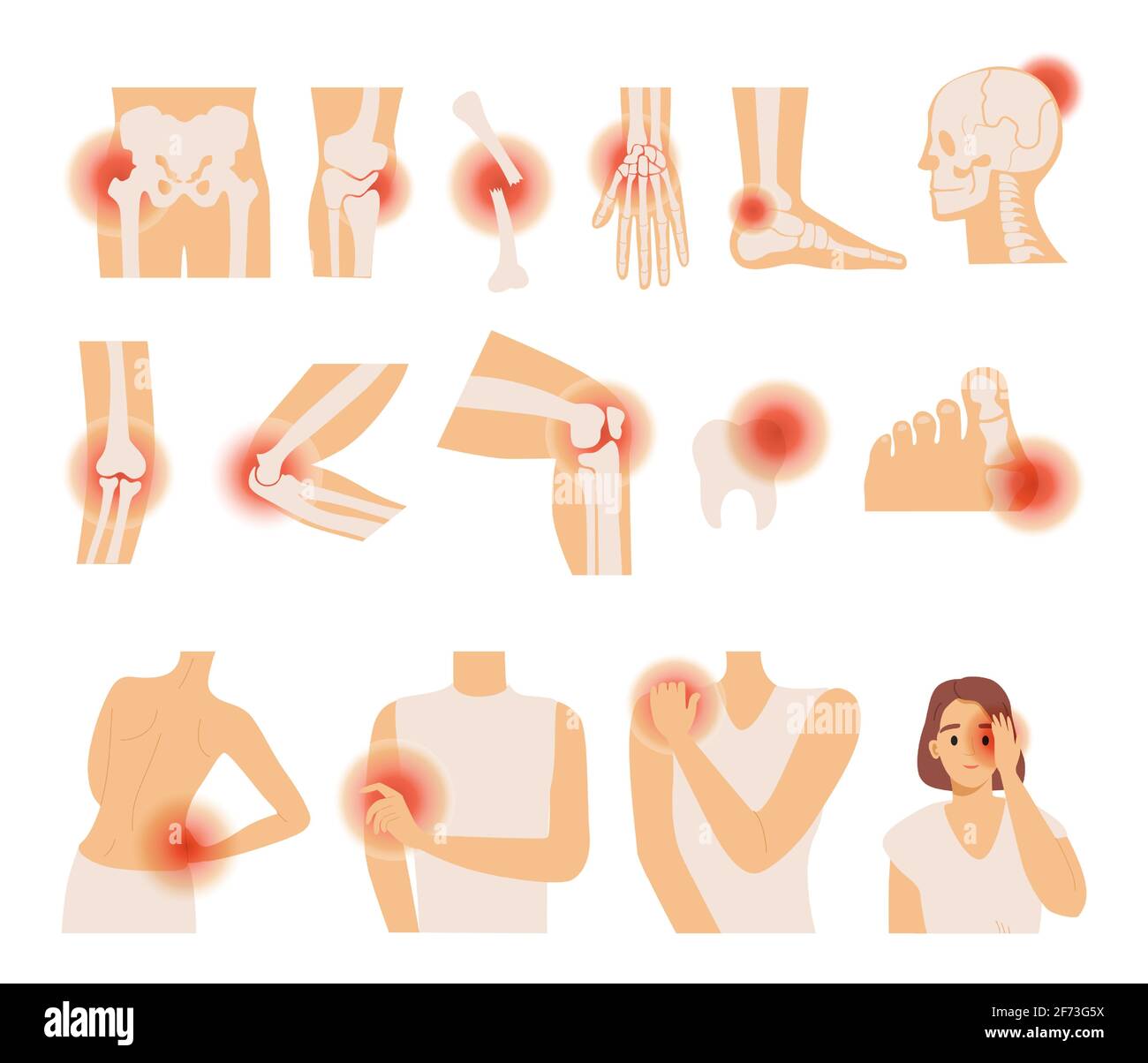 Set of different body pain vector flat illustration. Headache, pain in the arm, leg, shoulder, and lower back. Migraine and toothache concept. Painkiller, rheumatology, or rheumatic disorder. Stock Vector
