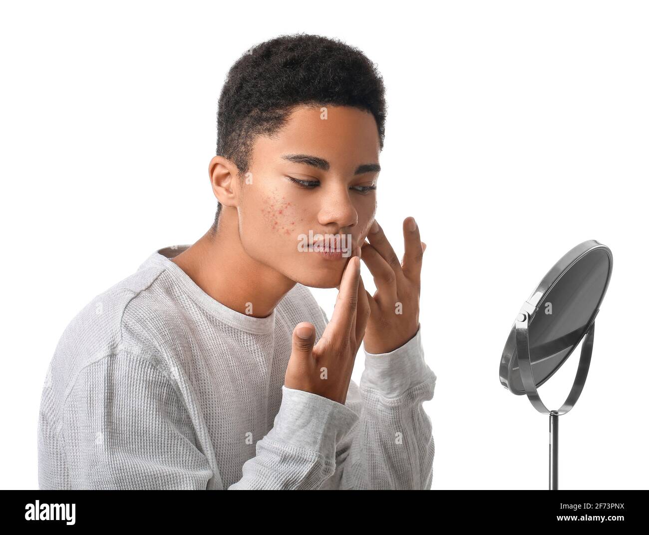 African American Teenage Boy With Acne Problem On White Background   African American Teenage Boy With Acne Problem On White Background 2F73PNX 