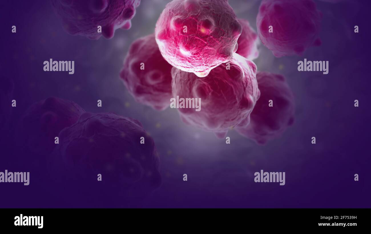 Brain tumour cells hi-res stock photography and images - Alamy