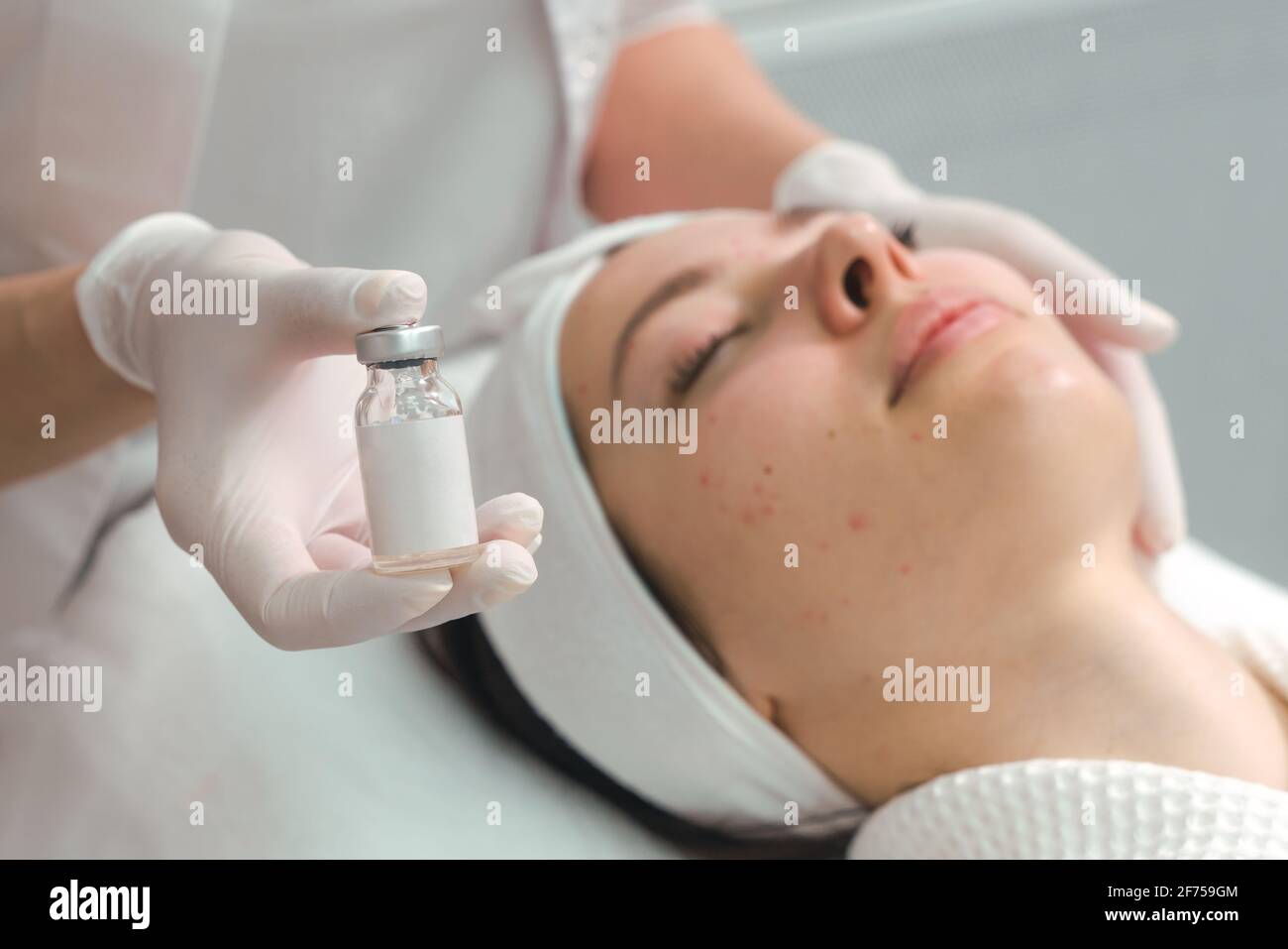 A young woman in a cosmetology clinic, undergoing acne treatment with injections. An effective remedy for acne Stock Photo