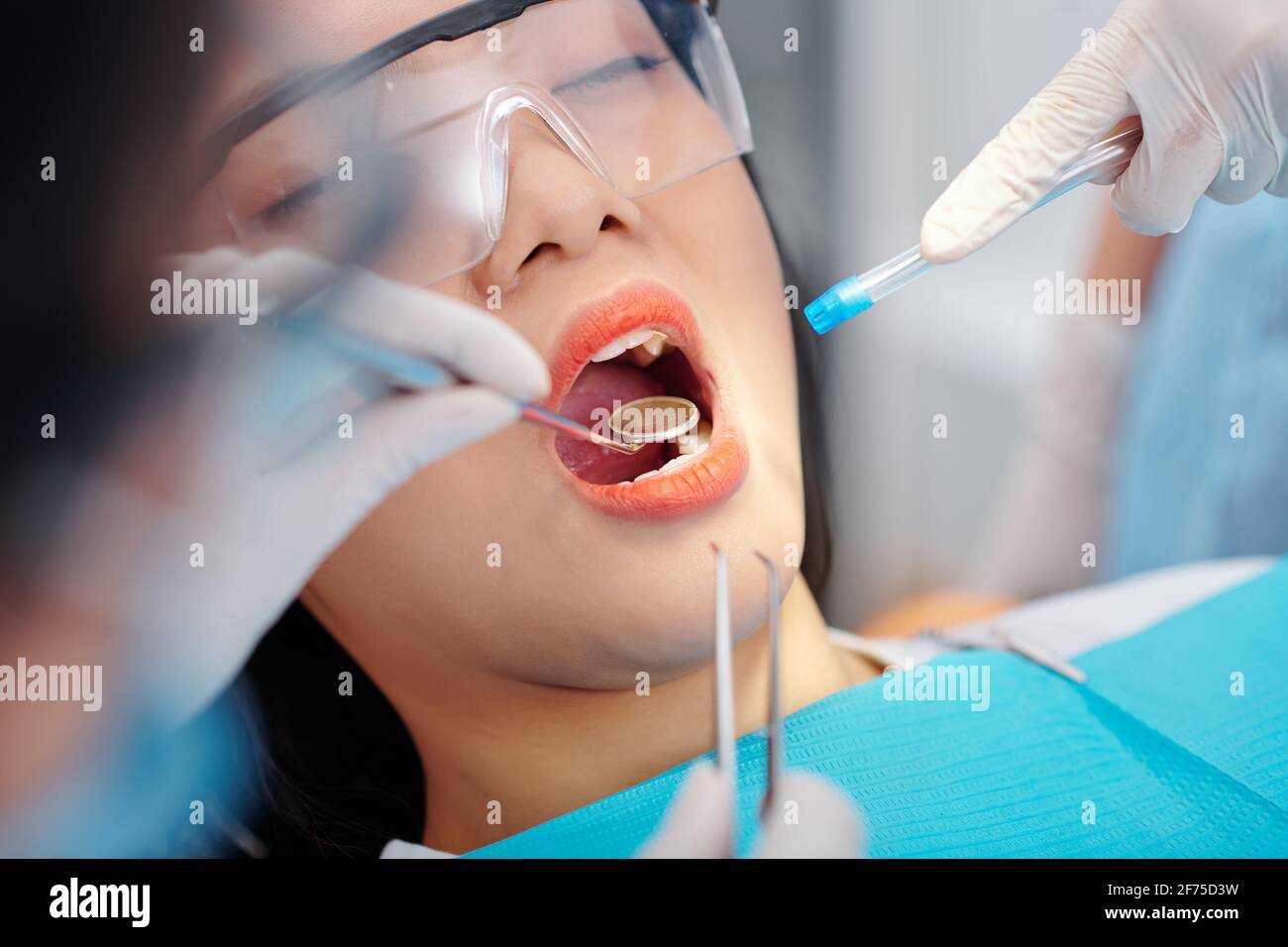 Closeup image of dentist with mirror and saliva ejector examining