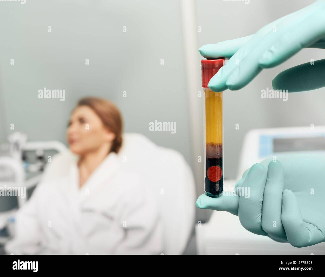 Test tube with blood plasma in beautician's hands for plasmolifting, over background woman patient at a beauty salon before PRP therapy Stock Photo