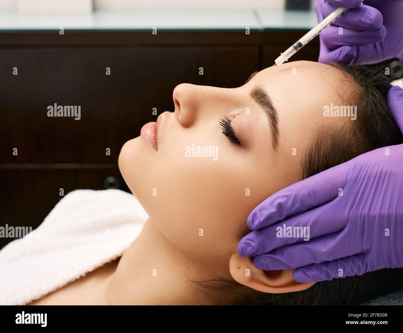 beauty injections into beautiful face. smoothing of mimic wrinkles around  the eyes using biorevitalization Stock Photo - Alamy, around smoothing 