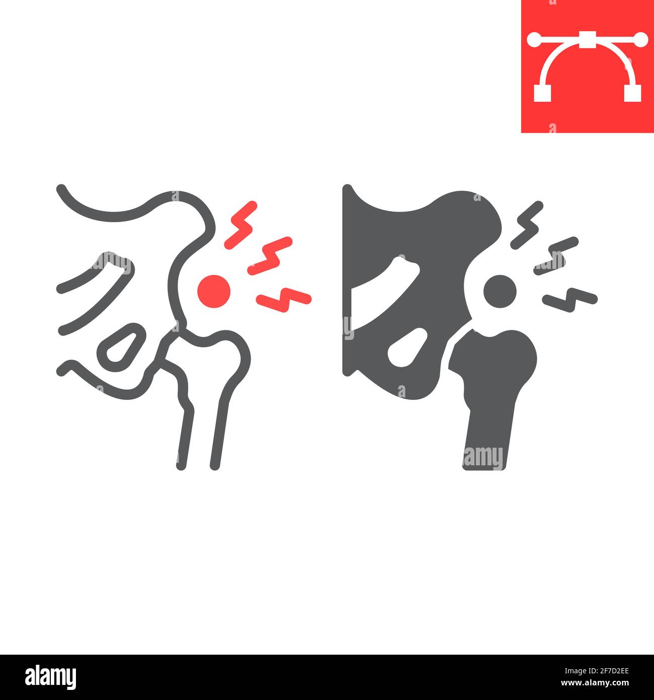 Hip dysplasia Stock Vector Images Alamy