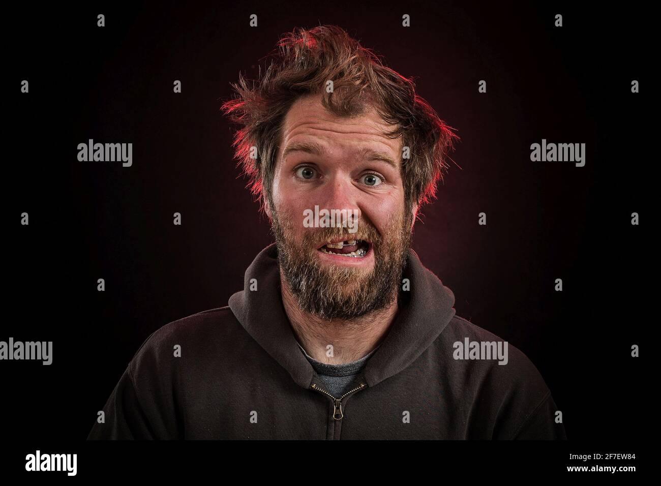 A goofy man with a beard, dental braces on a dark red lit background with brown hoodie or sweater and electrified hair. Stock Photo