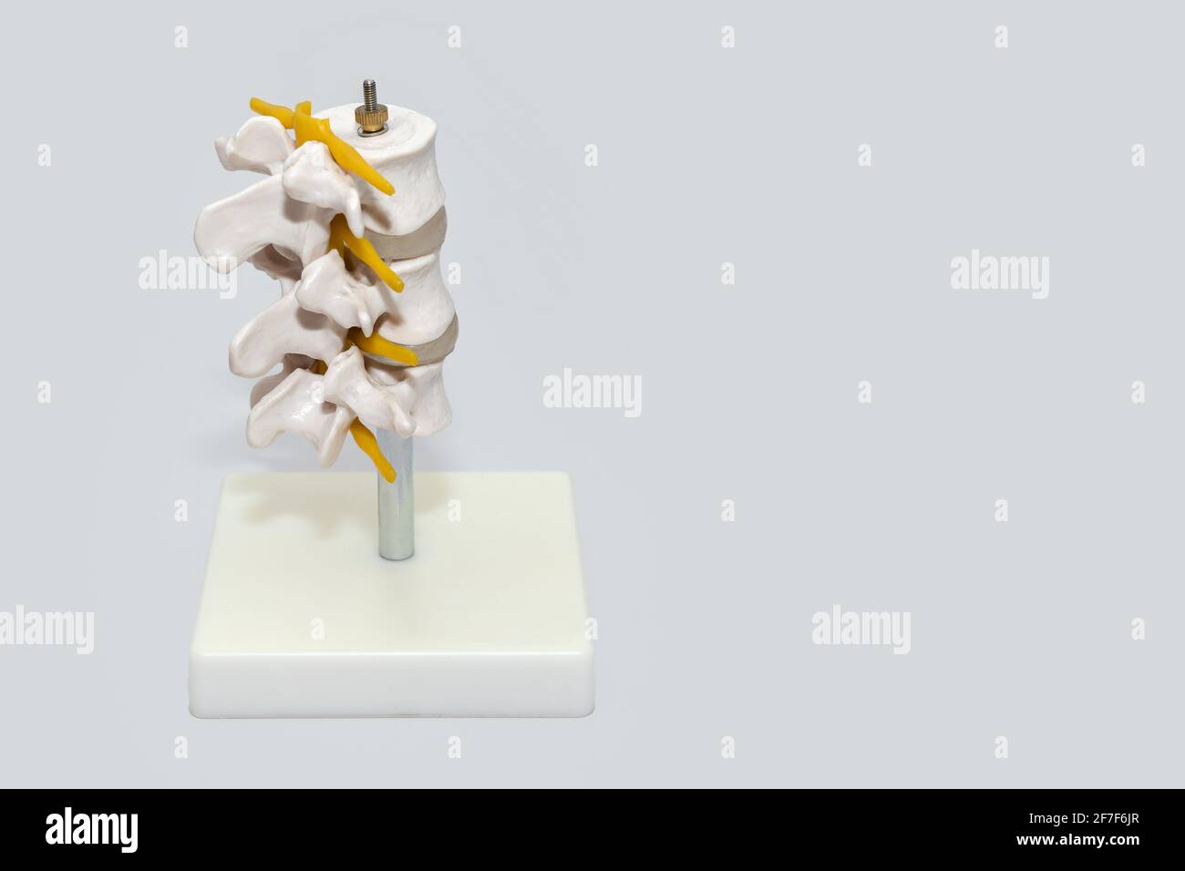 Human spine plastic model for surgery in clinic. Anatomical models of
