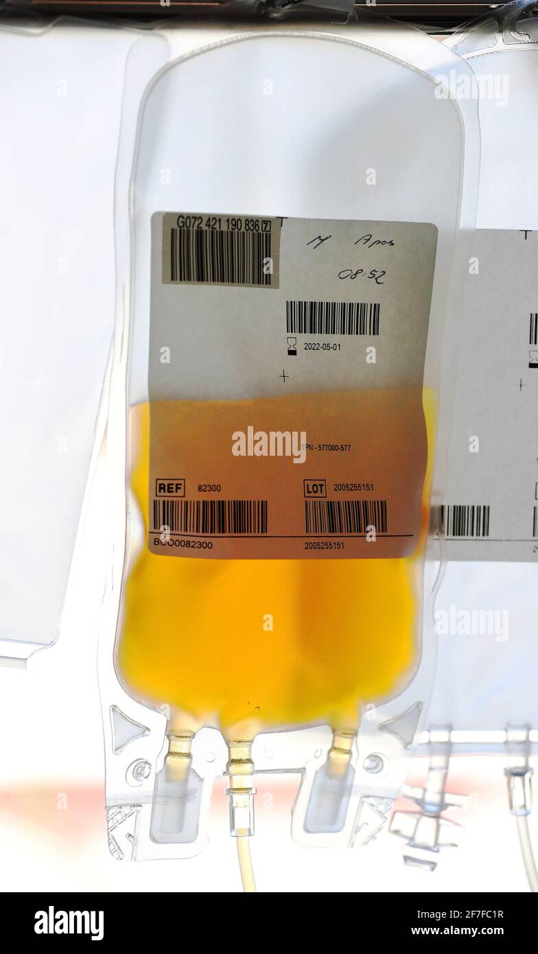 A bag of plasma hangs above an apheresis machine, which separates plasma from blood, as people donate blood plasma for medicines for the first time in more than 20 years at the Twickenham Donor Centre, south-west London, after a ban on the procedure was lifted in February. The ban was originally imposed in 1998 amid concerns about the spread of a human variant of BSE – dubbed 'mad cow disease' – known as Creutzfeldt Jakob Disease. Picture date: Wednesday April 7, 2021. Stock Photo
