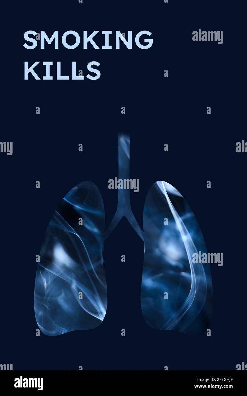 Smoker lungs, full of smoke. Vertical image with dark blue background and text Smoking Kills. Concepts of World No Tobacco Day, quit smoking and healt Stock Photo