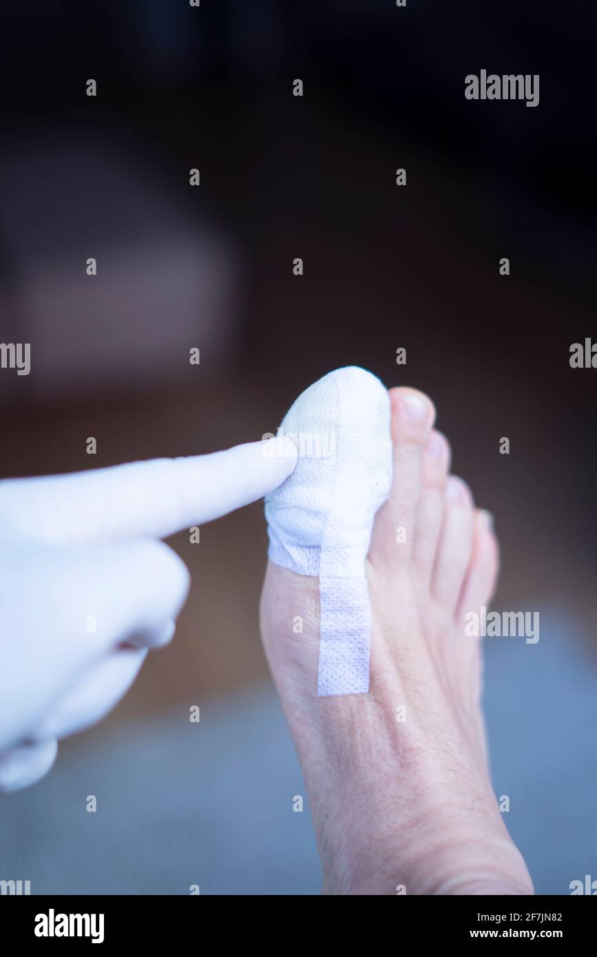 Foot big toe bandage injured feet in medical clinic hospital center
