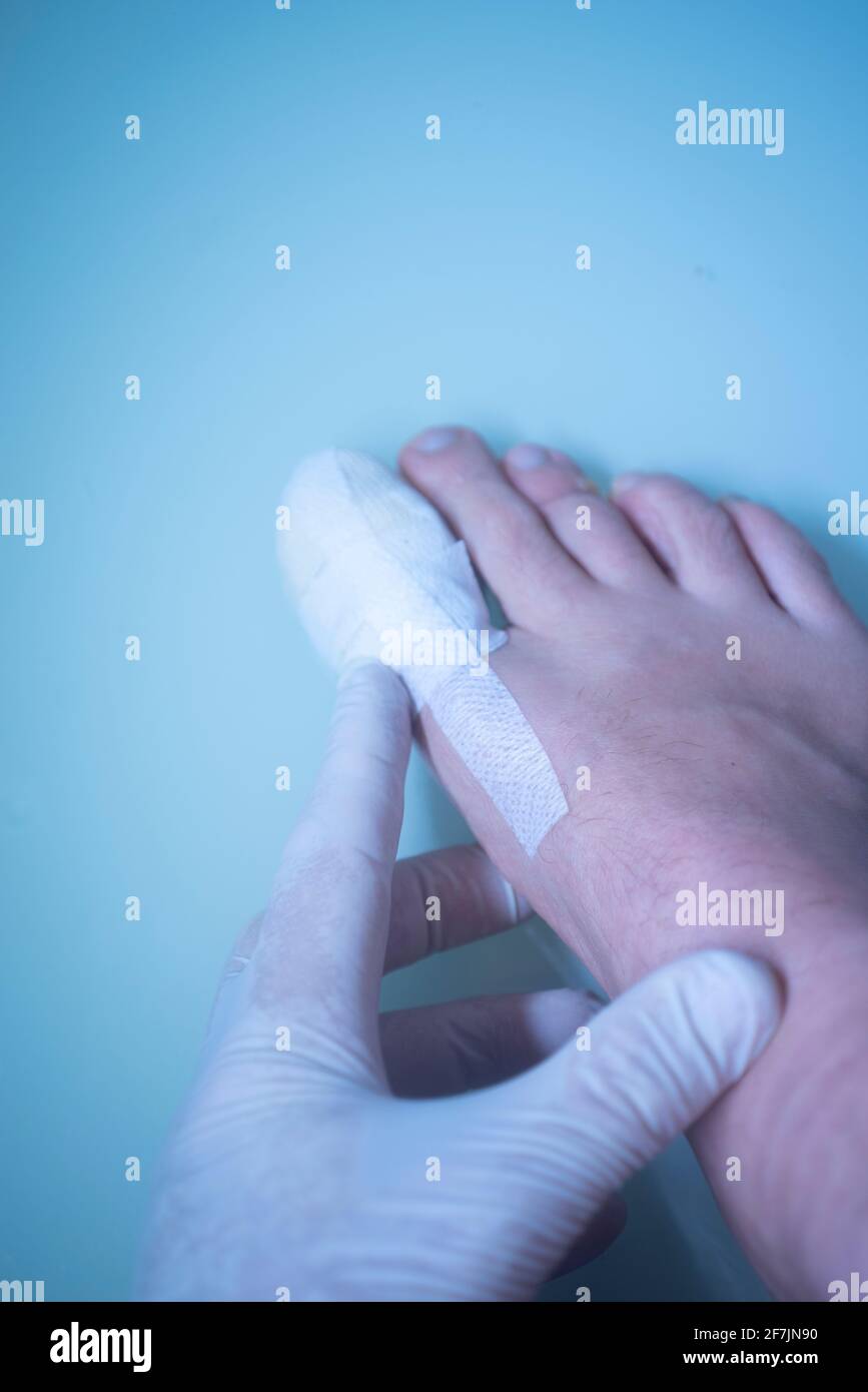Big toe fracture hires stock photography and images Alamy