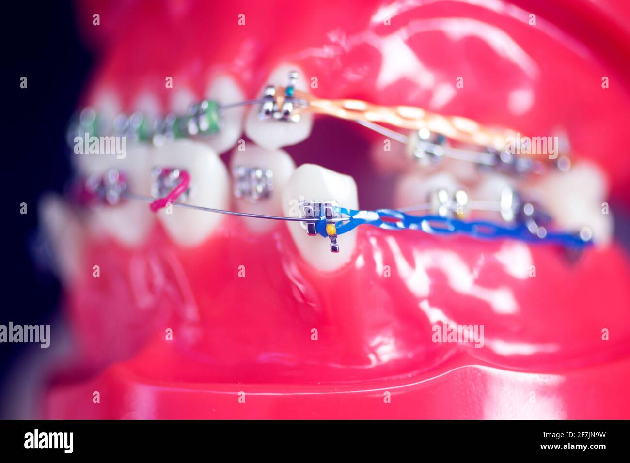 Dental teeth aligner bracket teaching student model showing gums and