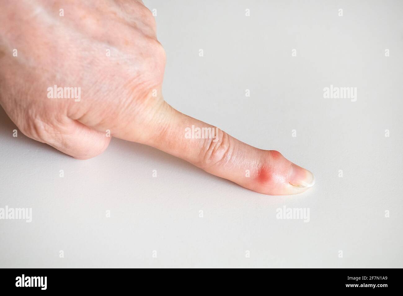 Sick female fingers of an elderly man's hands on a white background. Stock Photo