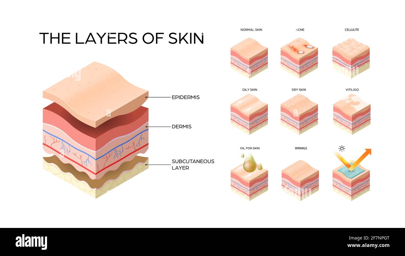set different types skin layers cross-section of human skin structure skincare medical concept flat horizontal Stock Vector