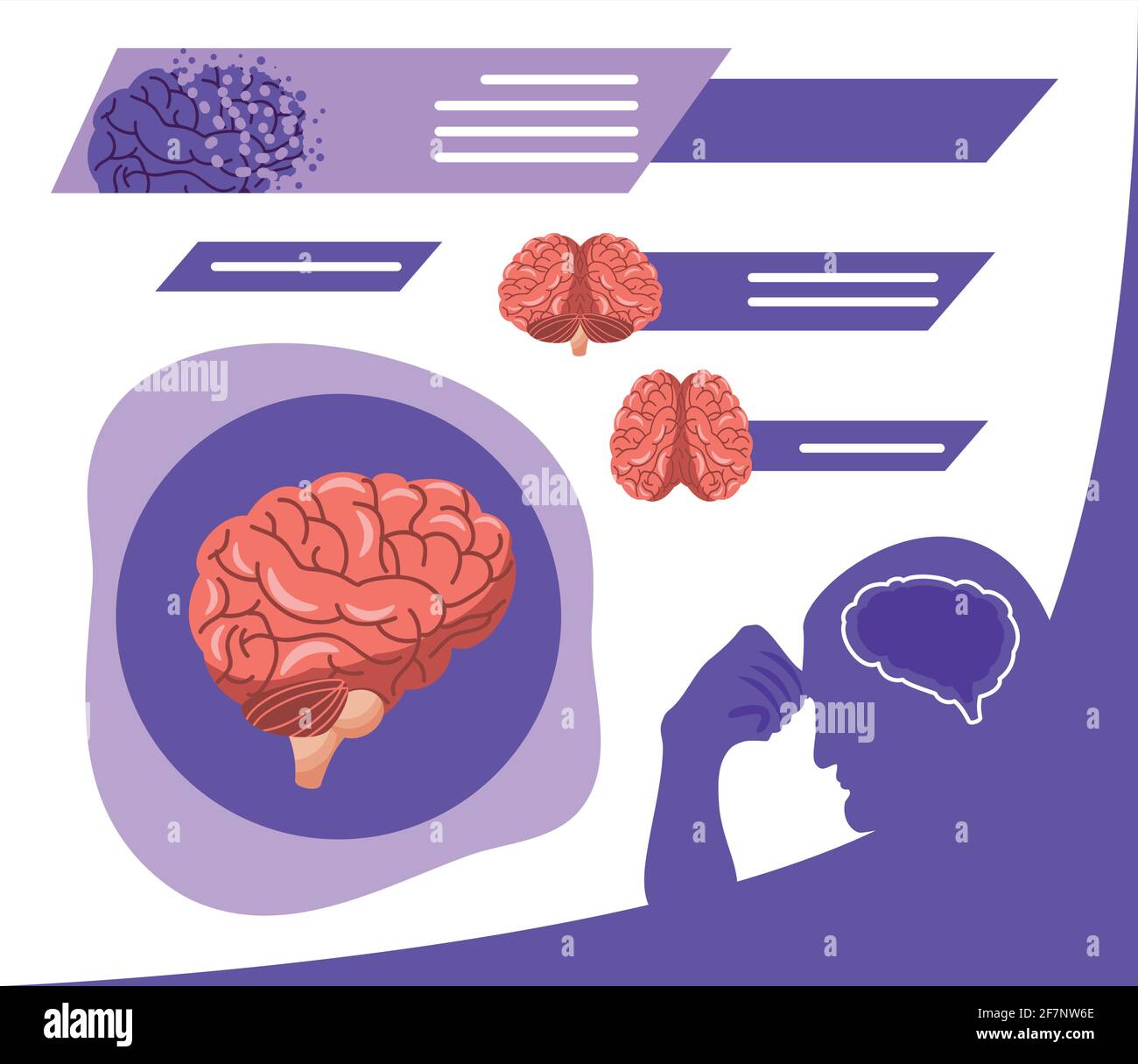 alzheimer human brain Stock Vector Image & Art - Alamy