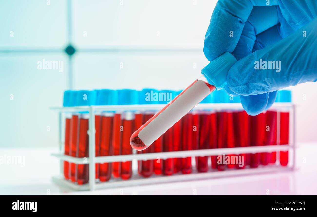 Test tube in doctor hand with empty space Stock Photo