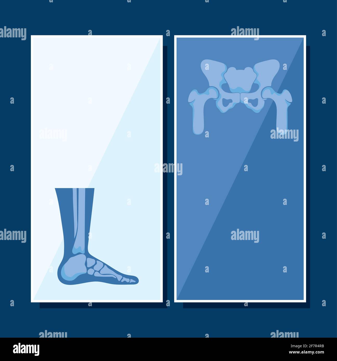 rheumatology banner set Stock Vector Image & Art Alamy