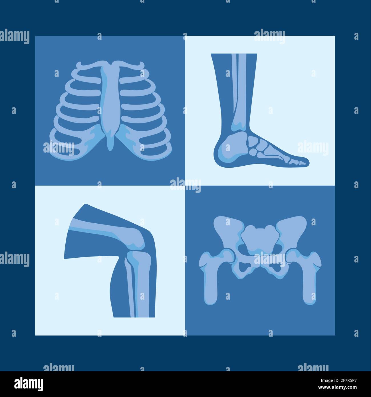 rheumatology bones designs Stock Vector Image & Art - Alamy