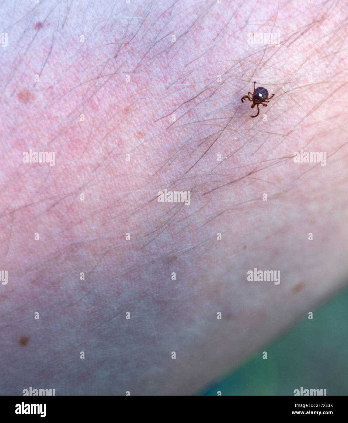 A lone star tick, a common vector of diseases, crawling on an arm Stock Photo