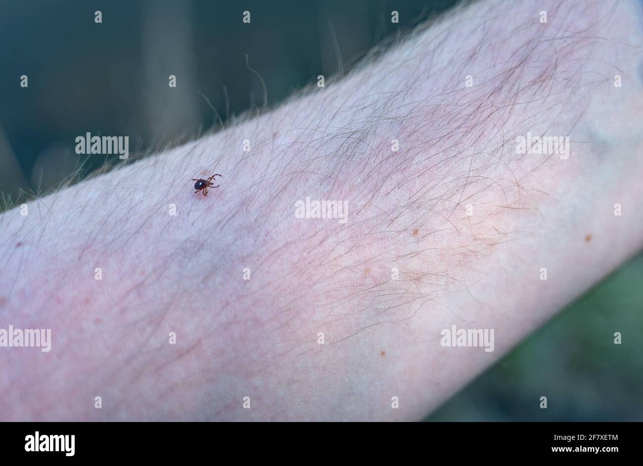 A lone star tick, a common vector of diseases, crawling on an arm Stock Photo
