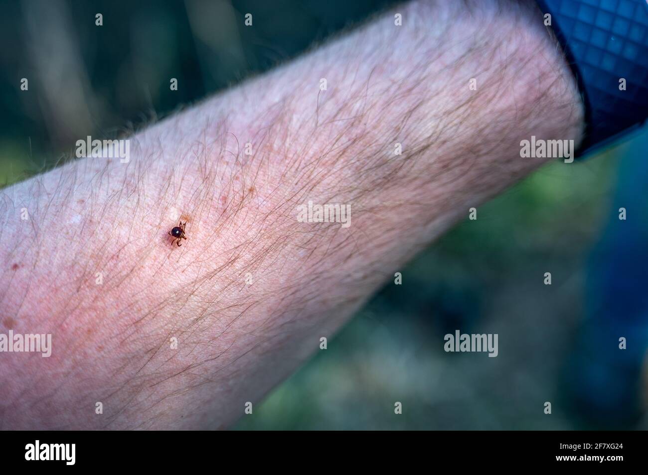 A lone star tick, a common vector of diseases, crawling on an arm Stock Photo
