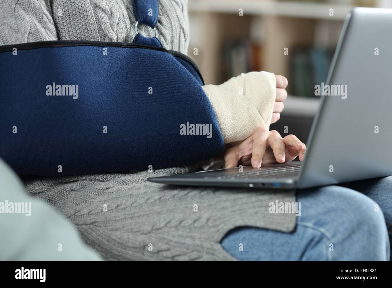 Close up of a woman with broken arm wearing sling using laptop sitting at home Stock Photo