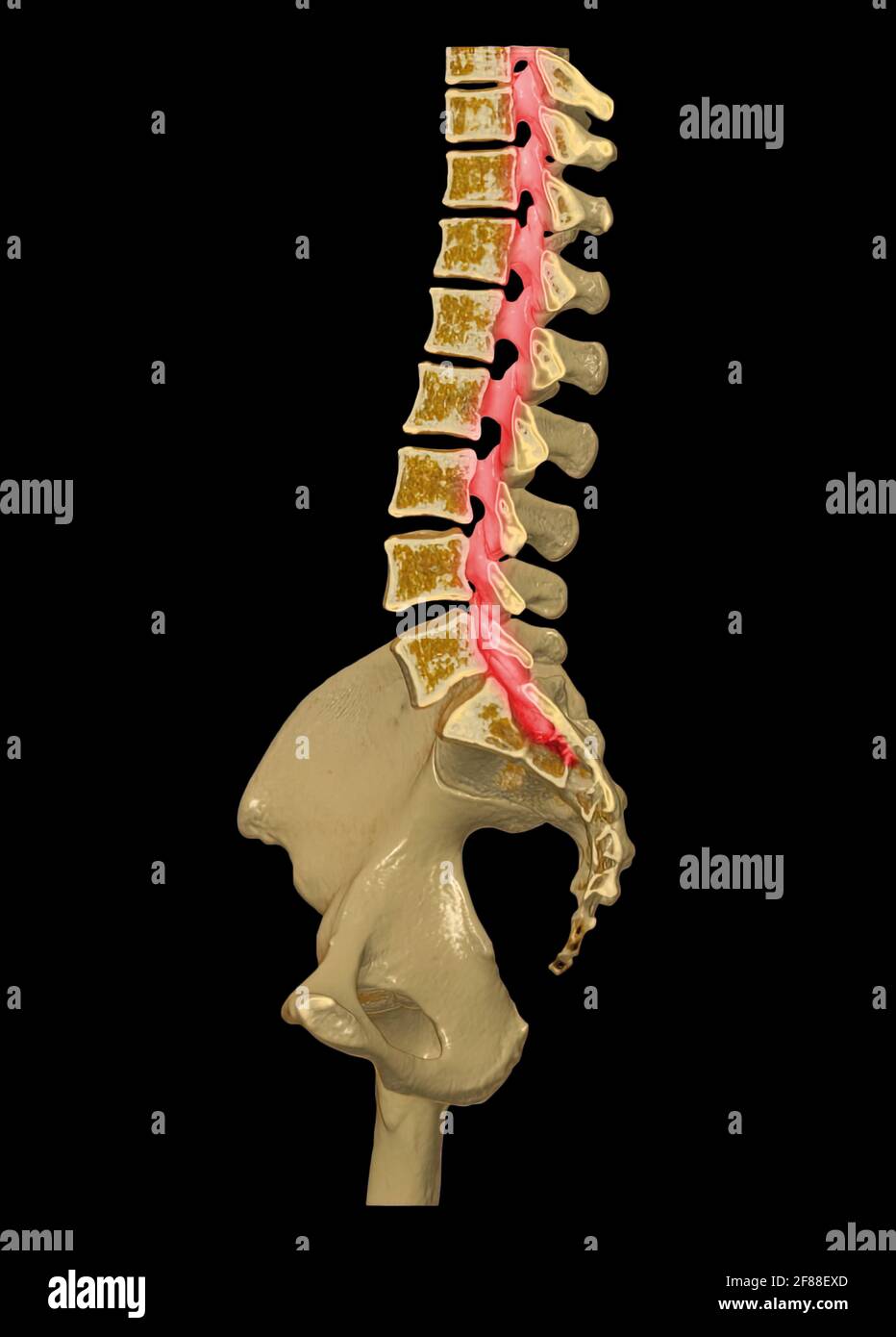 CT Lumbar spine or L-S spine 3D rendering image sagittal view 3D ...