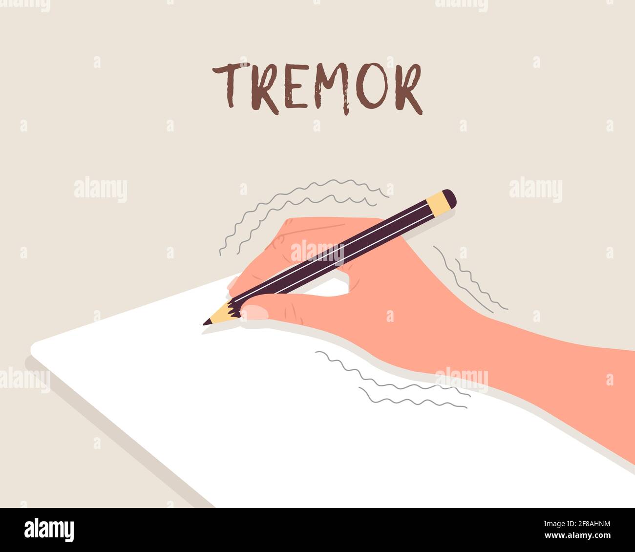 Tremor hands. Primary symptom Parkinson disease. Arms writing with a pen. Physiological stress symptoms. Vector illustration in flat cartoon style Stock Vector