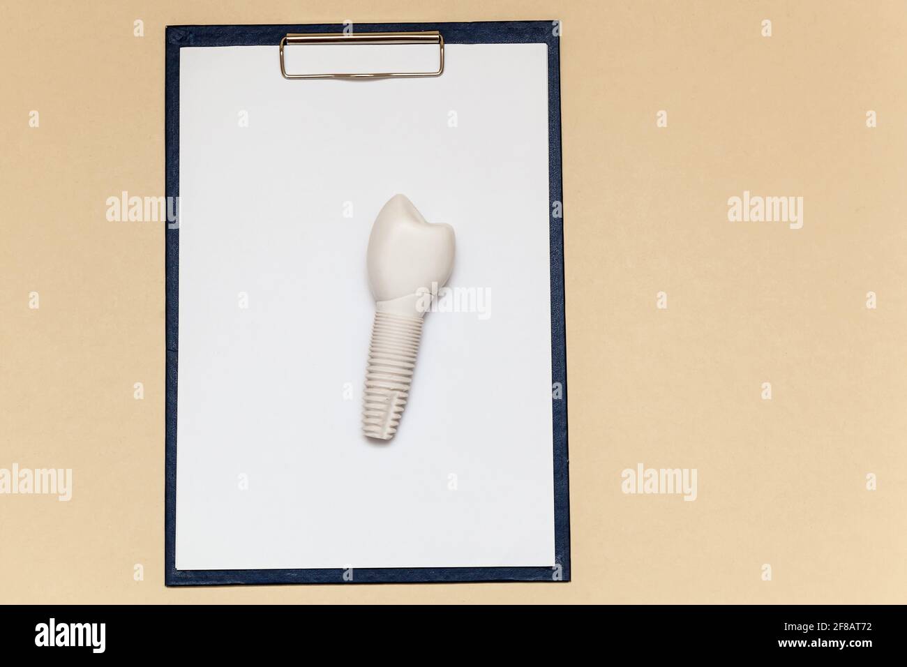 Dental implant and folder with clip for paper sheets A4 on beige ...