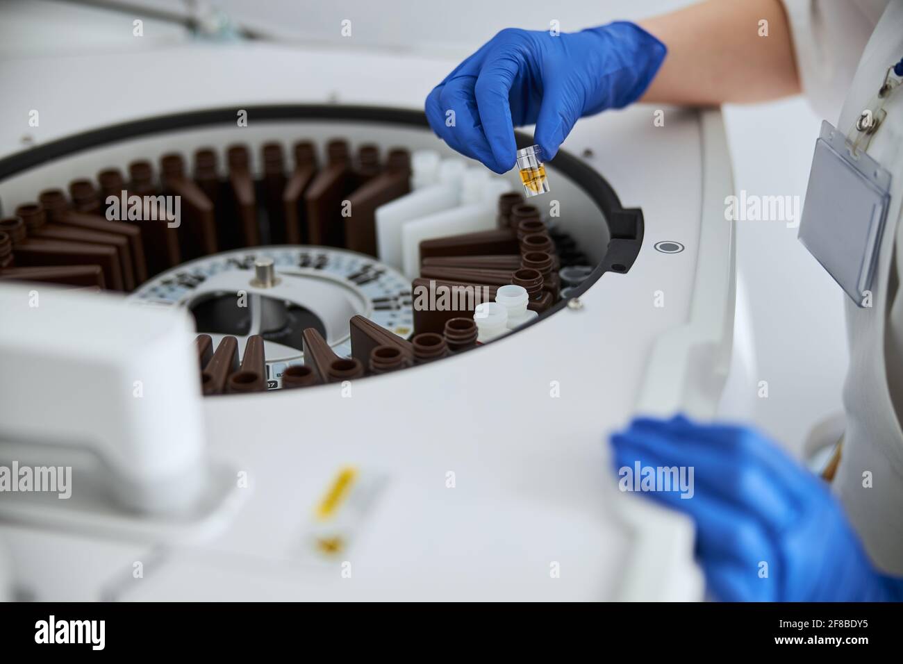 Scientist performing a lab analysis using a clinical chemistry analyzer