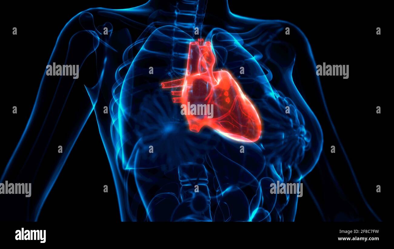 Heart disease xray hi-res stock photography and images - Alamy