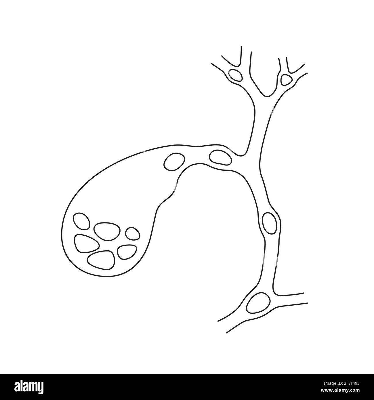 Variants of the location of stones in the gallbladder and bile ducts. Schematic drawing for cholelithiasis, gallstone disease. Stock Vector