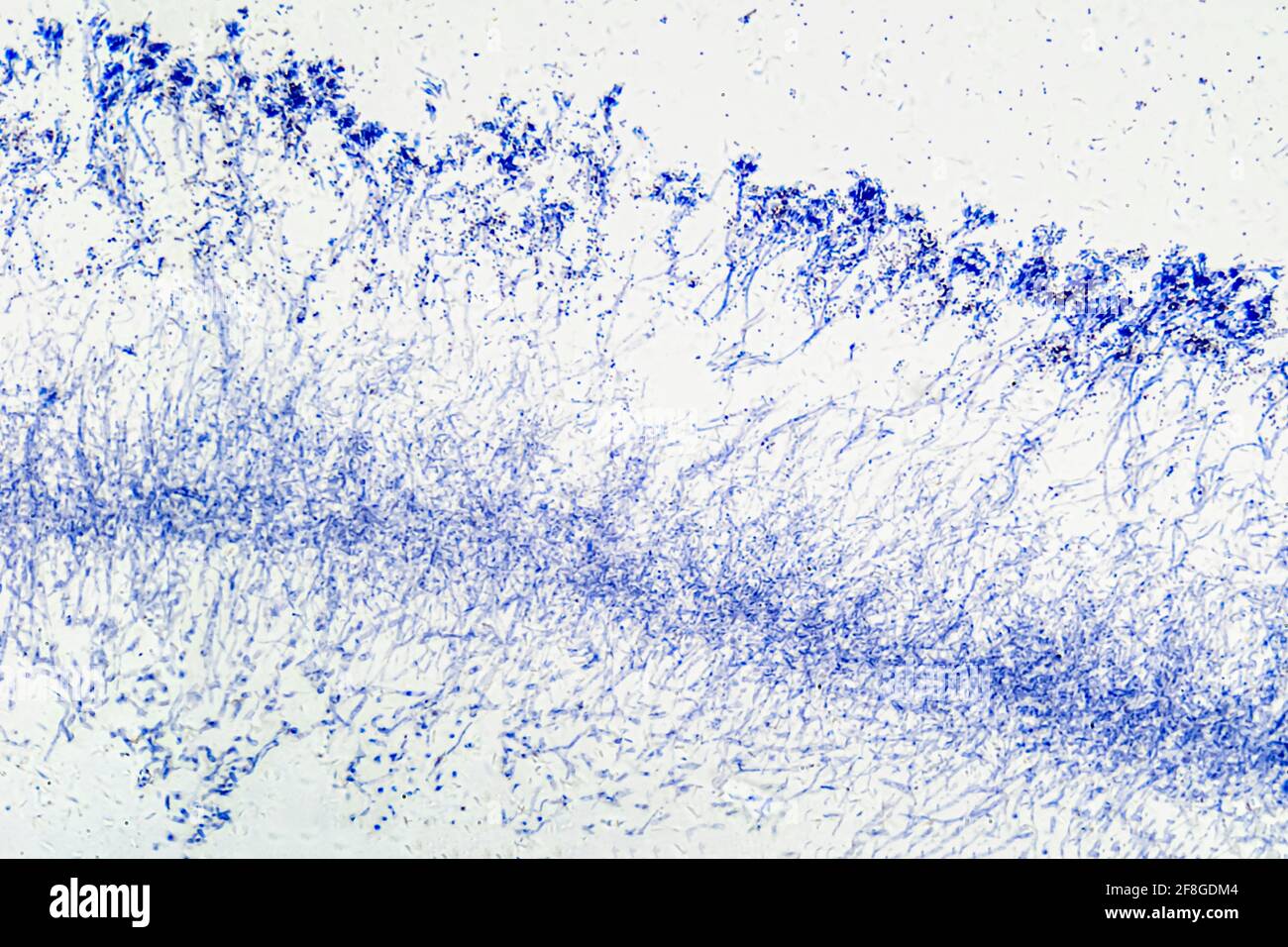 Penicillium, ascomycetous fungi, under a microscope. Mycelium, the vegetative part of the fungus, a mass of branching, thread-like hyphae. Stock Photo