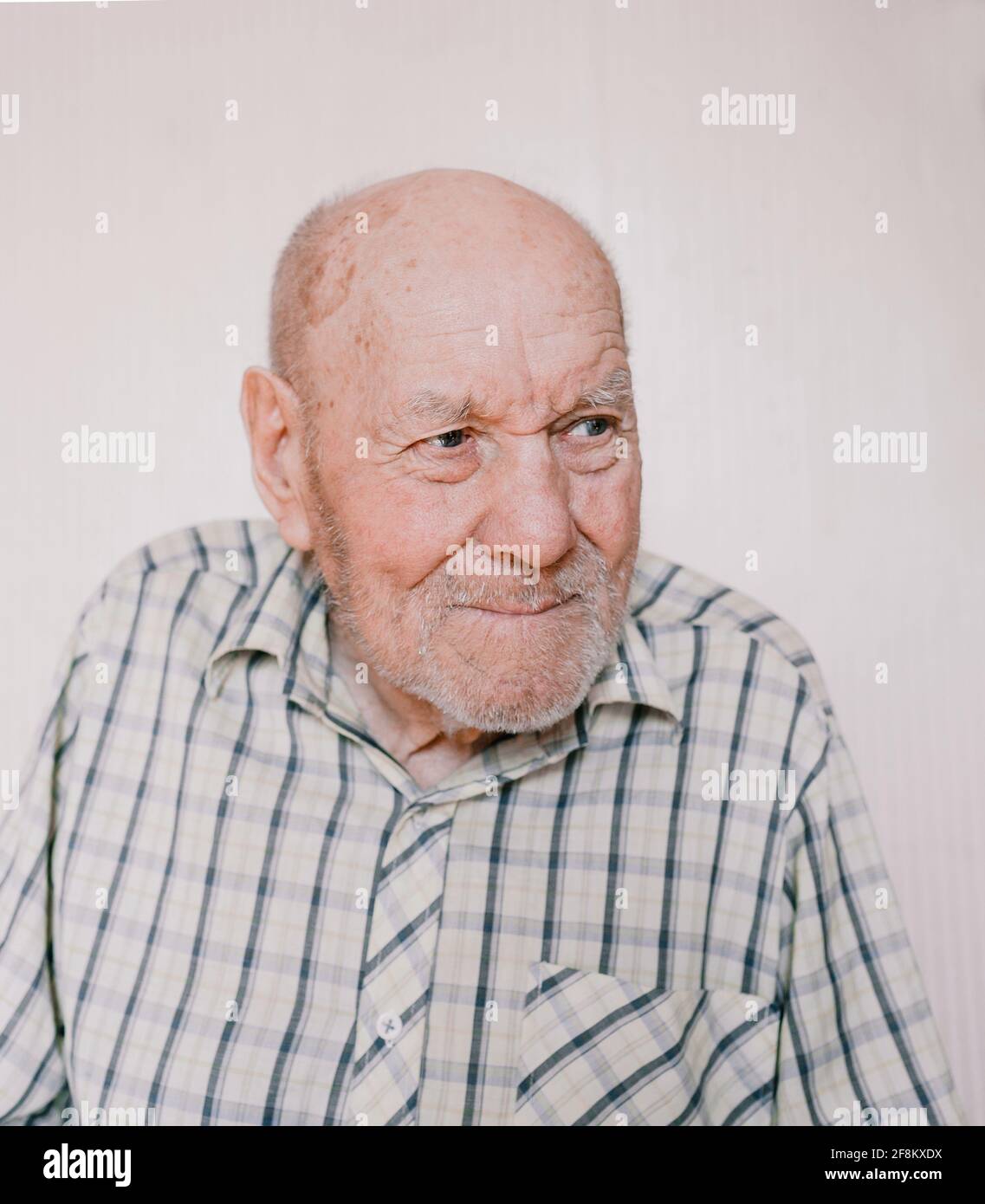 Age Spots High Resolution Stock Photography And Images Alamy Age Spots High Resolution Stock Photography And Images Alamy