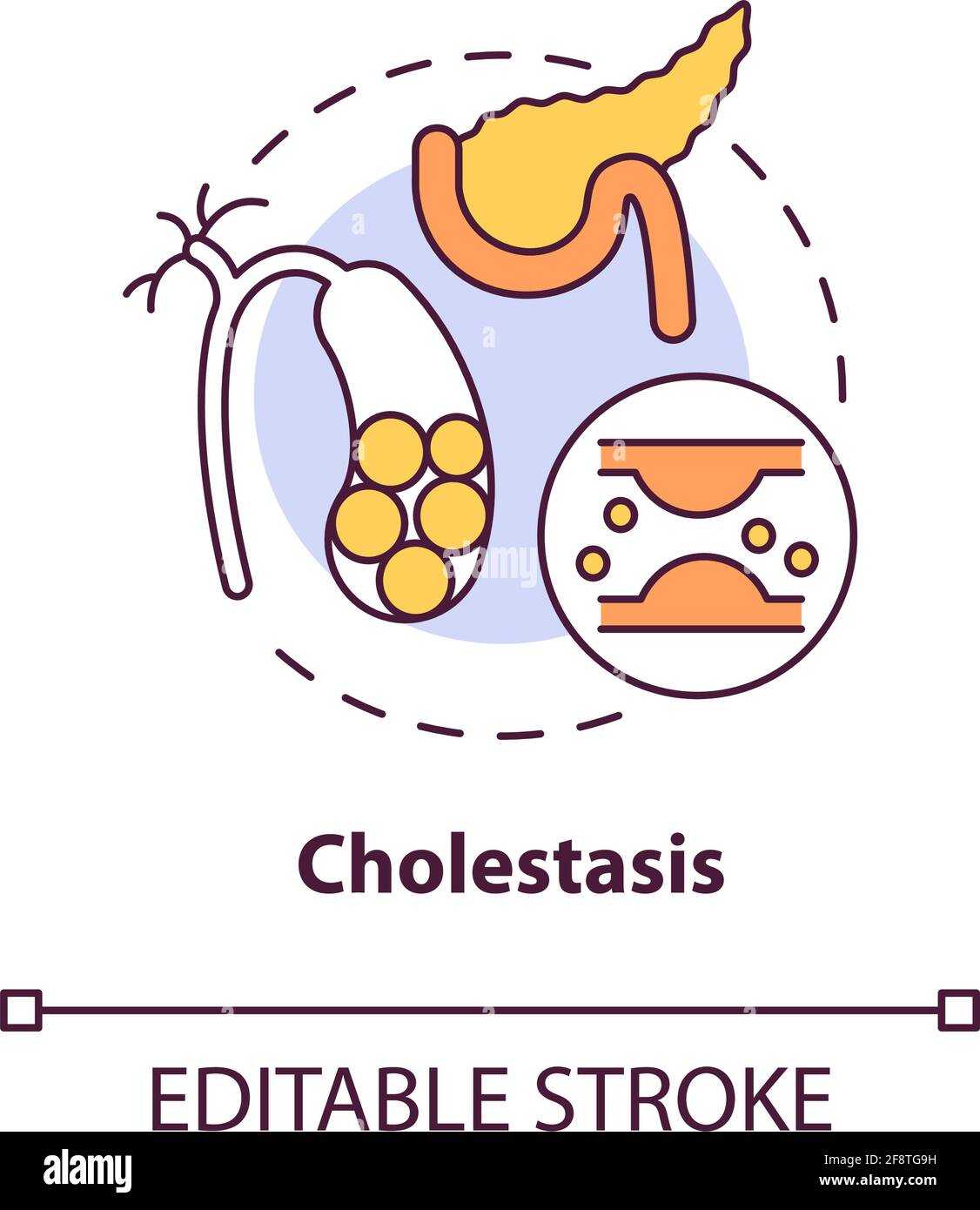 Cholestasis concept icon Stock Vector Image & Art Alamy