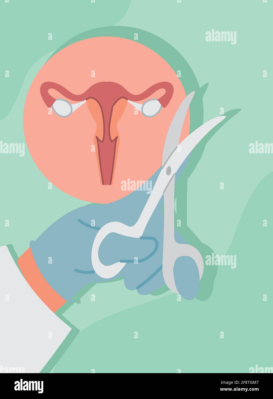 Gynecology operation Stock Vector Images - Alamy