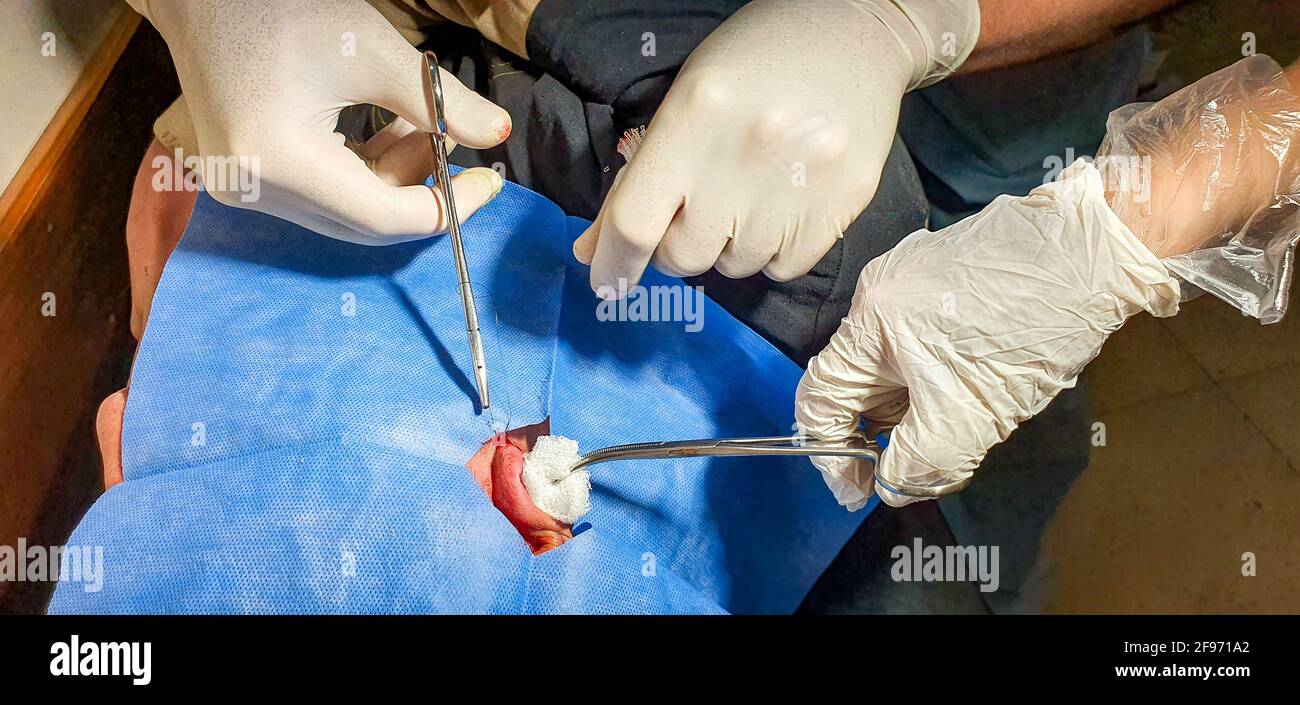 Closeup shot of the doctor's hands doing the ear surgery Stock Photo