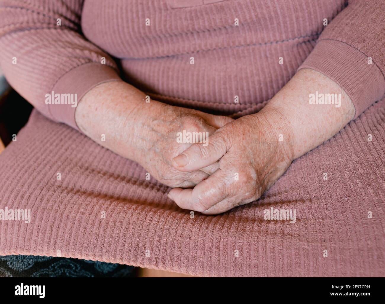 Age Spots Hands High Resolution Stock Photography And Images Alamy