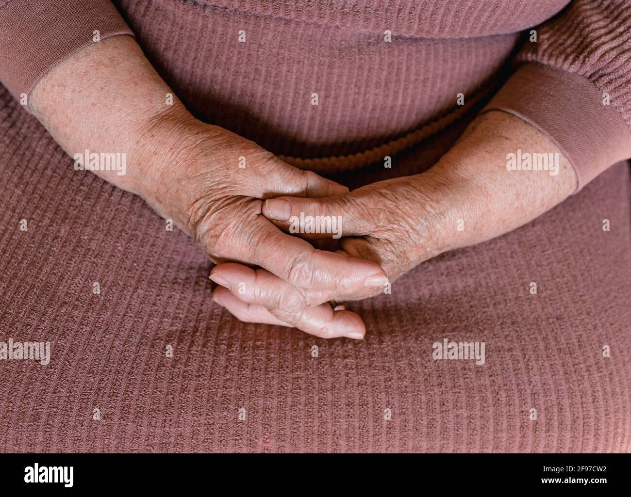 Age Spots Hands High Resolution Stock Photography And Images Alamy