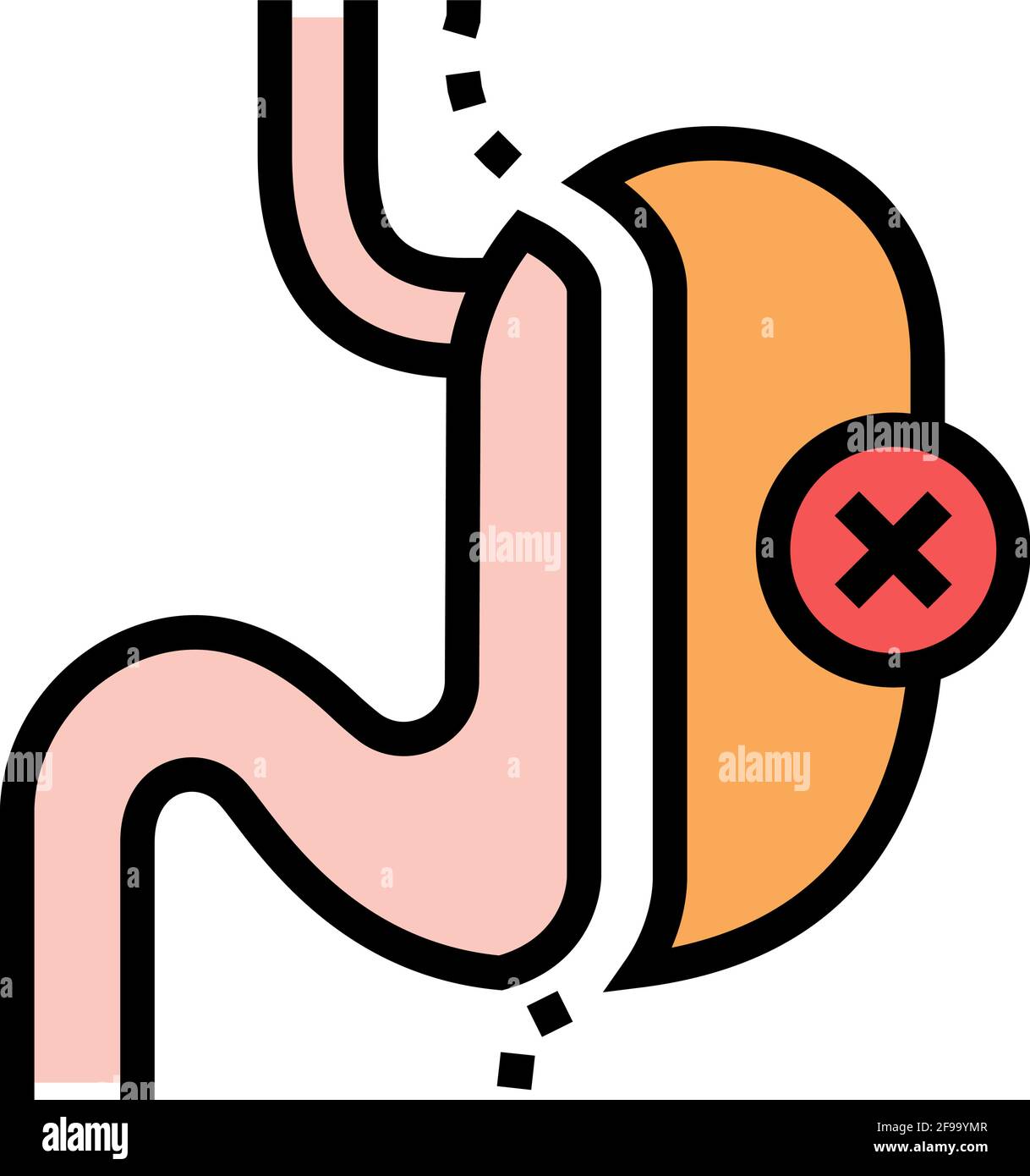 sleeve resection bariatric color icon vector illustration Stock Vector ...