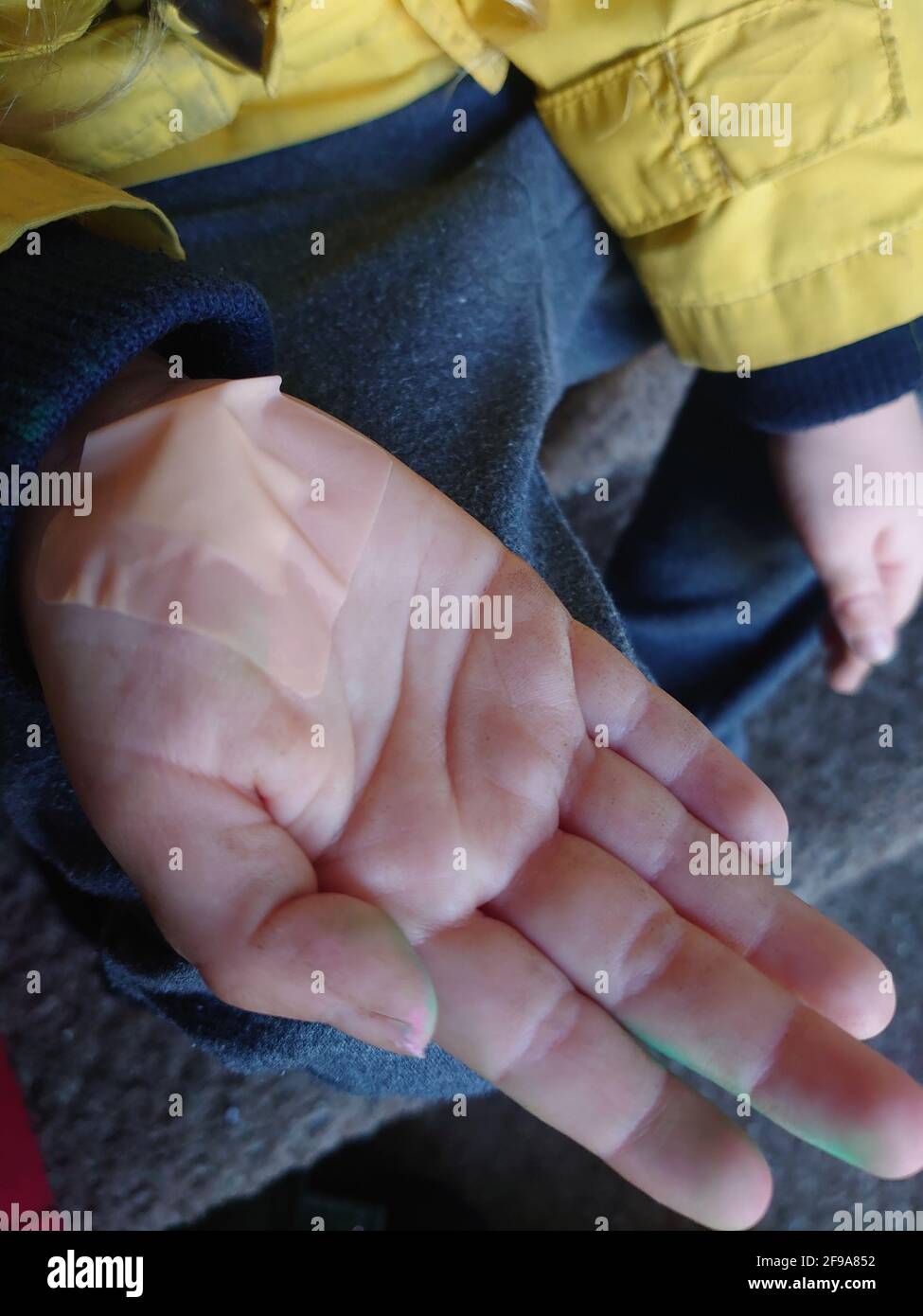 Closeup view of a kid showing his hand with a bandaid inside the palm